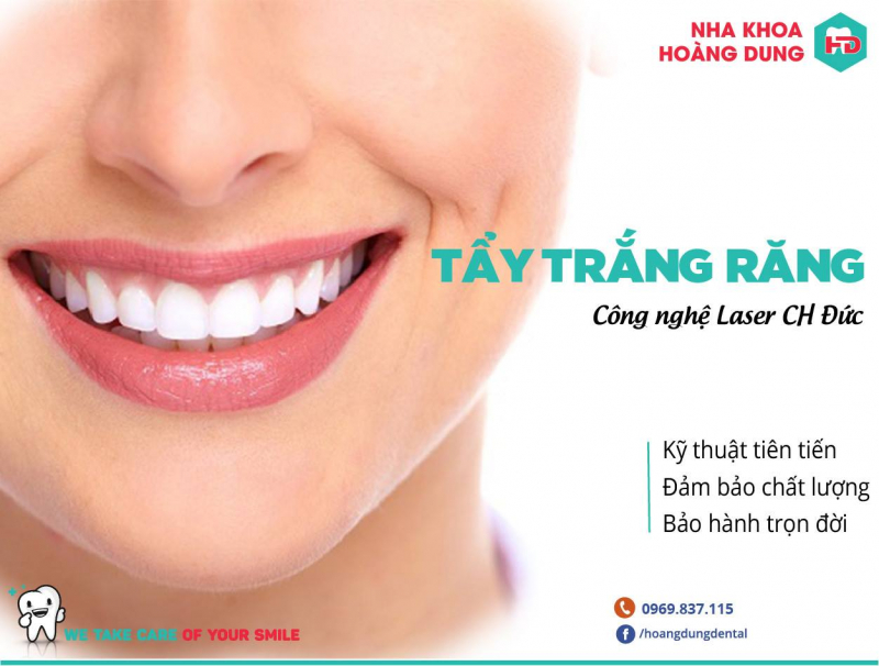 tẩy trắng răng tốt nhất tại vinh - Nha khoa thẩm mỹ Hoàng Dung