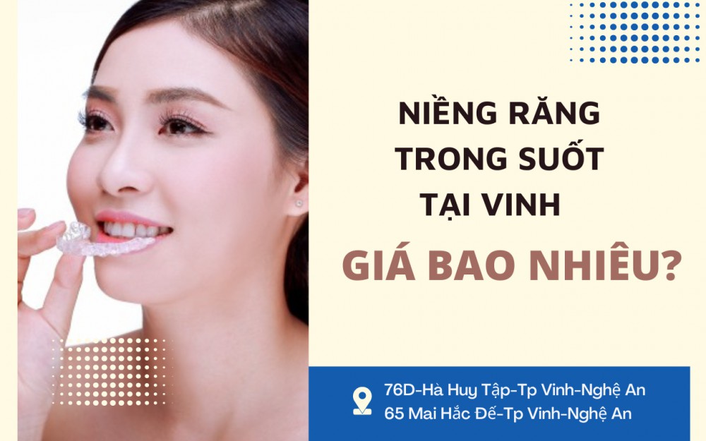 Niềng răng trong suốt tại Vinh giá bao nhiêu?