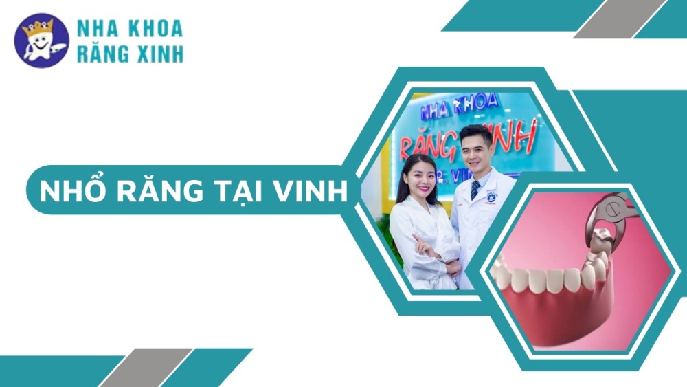 Nhổ răng tại Vinh – Top 6+ địa chỉ đáng tin cậy (2024)