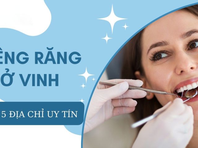 Niềng răng ở Vinh – Top 5 địa chỉ uy tín (2024)